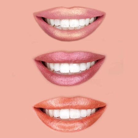 שלוש תמונות תקריב של פיות מחייכות עם גווני שפתון מארז מטאלי מיוחד: למעלה ורוד בהיר, באמצע סגול-ורוד, ולמטה כתום. בכל אחת מהן שיניים לבנות ורקע בצבע אפרסק. | אלמאס קוסמטיקה – מתנה מושלמת של טיפוח ויוקרה